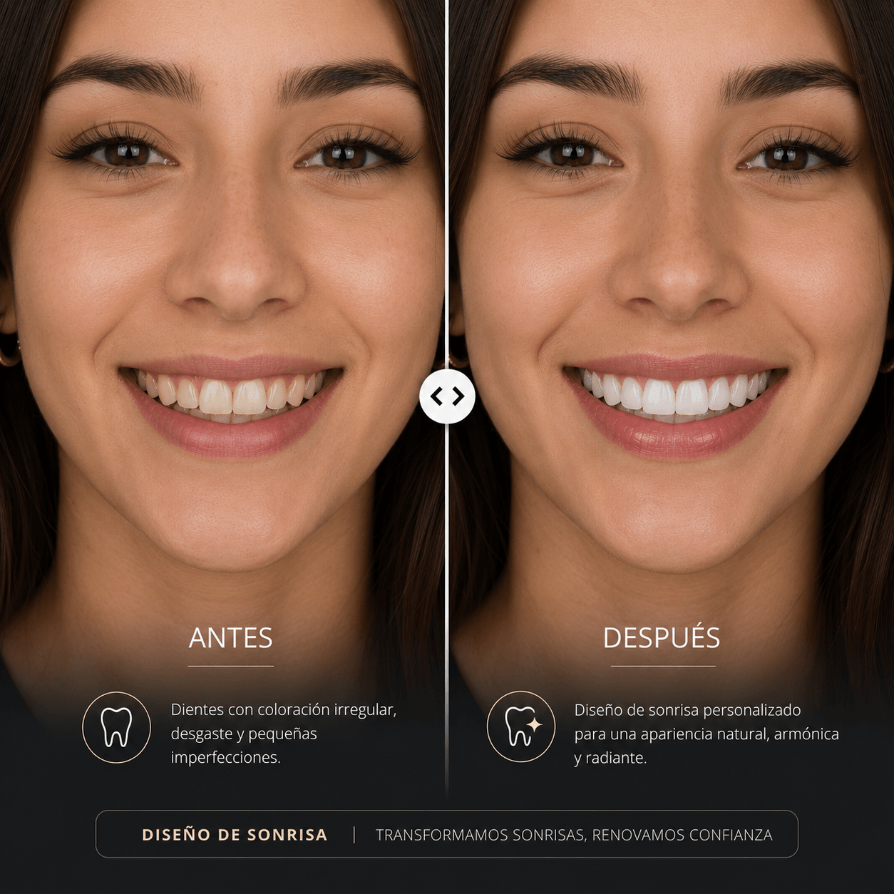 Caso diseño de sonrisa