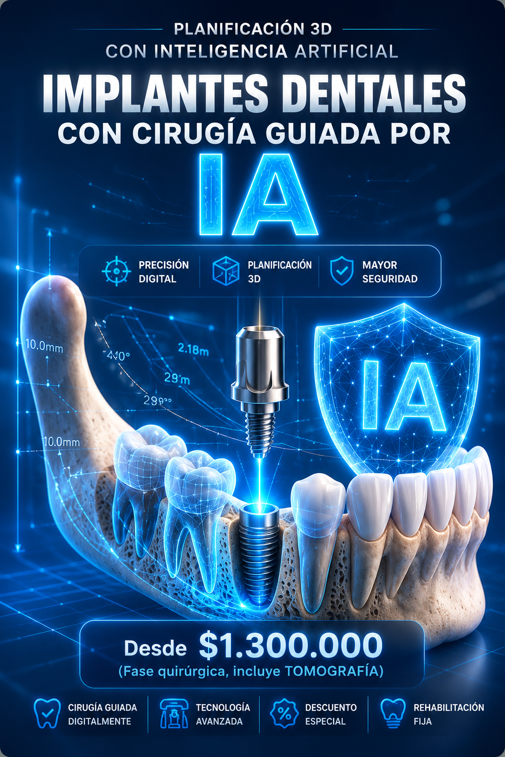 Implantes dentales con cirugía guiada por IA